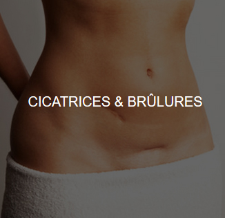 cicatrices-brulures-LPG